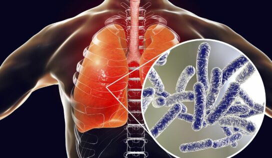 Rentokil Initial: Nuevas medidas para proteger la salud pública: así es el nuevo Real Decreto para la prevención y el control de la legionelosis